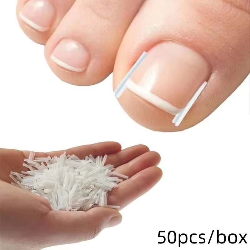 50Pcs Ingrown Toenail Correction Tool Ingrown Toe Nail Treatment Elastic Patch Sticker Straightening Clip Brace Pedicure Tool